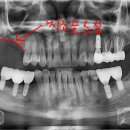 좌동로 93 이미지