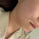 아름다운의원 | 논현역 더아름다운의원 온다리프팅 후기
