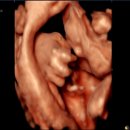 창원파티마병원 | [임신 30주] 창원파티마병원 백일해주사 후기, 남편과 함께 예방접종