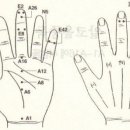 구안와사 한달-치료완료(95%완치-나머지 5% 휴유증) - 휴유증 치료 과정까지~~~ 이미지