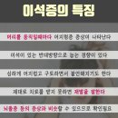 이석증의 특징 이미지