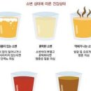 소변검사로 알수있는것 단백뇨 거품뇨 소변색깔 건강 상태 이미지