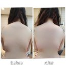 미네랄 피부&전신관리 인천논현점 | 인천논현체형관리 슬림관리 미네랄피부 전신관리 인천논현점에서 등후면관리 받은 후기