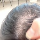 성환-02 | 상계 미용실 에이바헤어 상계역점 성환 실장님 두피클리닉 시술후기