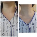 화순전남대학교병원1층 안내데스크 화장실 | 결절 수술,로봇수술 후기, 갑상선결절수술시 필요한것,갑상선수술후 주의사항,슬기로운병원생활,상세후기