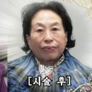 서우림 | 전원주, 피부 리프팅 후 변신! 변화의 시작은 500만원 투자?
