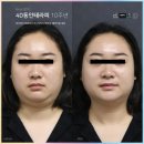 동안스킨테라피