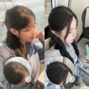 (주)라파메디 | [대구/수성구] 모발이식 대신 선택한 두피관리 라파드 탈모센터 1~21회차 기록