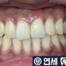 e-편한치과기공소 네이버블로그