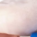 경대최강마취통증의학과의원 네이버블로그