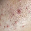 예미안피부과의원 이미지