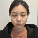 7019 | 모란역피부관리 오라스킨케어 신부관리 더플러스 윤곽케어 후기