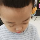 송우밝은안과 네이버블로그