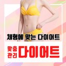 홍성철성형외과의원 네이버블로그