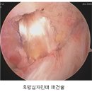 더열린병원 네이버블로그