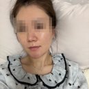 창원여드름피부 관리 잘하는 조엘랑더마랩 솔직 후기