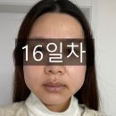 위드유 파트너스 | (광고)[양악수술/치아교정/치과위생사]사람은 역시 적응의 동물이닷,,,위드유 역류방지 베개 내돈내산