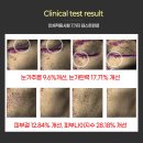 에스에이치개발(주) | 3세대 수소(하이드로젠)앰플~ [리쎄]하이드로젠 엑시젼트 리페어 앰플 재오픈~!! 미백, 주름개선의 2중...