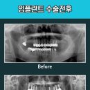 연세현플란트치과의원 이미지