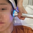 홍대 피부관리 다이브인투스킨 LDM 재생관리 후기