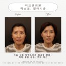 피브엔의원 | 사상피부과 피브엔의원 고객님 리얼 후기 2탄<원장님 ver>