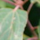 예덕피부관리 이미지