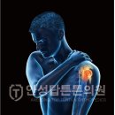 안성탑튼튼의원 네이버블로그