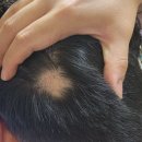 UR(김천시)-[자산로]-상-2 | 남자 원형탈모 치료기 - 2