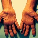 모란서울통정형외과의원 | 오금동 정형외과 손목터널증후군 수술 <총정리>