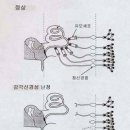 인공와우 수술 그 이면 이미지