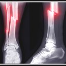 바로나은마취통증의학과정형외과의원 이미지