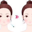 샤인톡스의원 | 🌟 설 연휴 특집: 빠른 회복력의 얼굴 시술 5가지 - 새해 새 얼굴로 시작하세요!