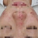 대전피부관리 너무 잘해주시는 쁨에스테틱