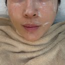 더 해움 | 영등포피부관리 해움에스테틱 모공관리 받고 차이났던 후기