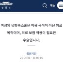 가슴축소수술 남자100만원 여자1000만원 이미지