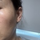 유픽의원1 | 피부고민 해결, 유픽의원 위례