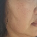 경인로216번길 | 부천 피부관리 더좋은뷰티샵 윤곽관리 받은 후기