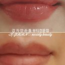 강자안손톱 이미지