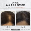두두스칼프