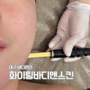 대구 달서구 바디관리 화이팅바디앤스킨 승모근 집중관리 후기