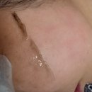 오마주 - 수원시 팔달구 세류로 91 | 천안 피부관리 어디가 좋을까? 첫 방문에 좁쌀여드름 원인까지 정확히 짚어준 오마주21 후기