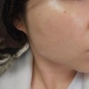 메디베드 | 울산피부관리샵 데자뷰메디스킨 울산점 주차