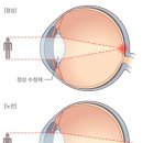 좋은의사들안과병원 이미지