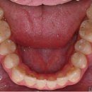 WE치과기공소 이미지