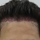 압구정맘모스헤어라인의원 이미지