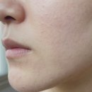에이무르 | 좁쌀여드름 클렌징 폼/밀크/오일 비교, 정착템 소개