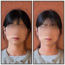 우심이돈심이 | 목포에스테틱 "스파뷰타임" : JH윤곽술