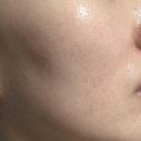 하나로약국 | 약국 재생크림 약국 화장품 추천 제품 여럿 써본 뒤 정착템 후기