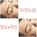 미인에스테틱 네이버블로그