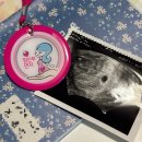 한마음산부인과의원 | 임신초기증상 임신 8주 계류유산 소파술 후기 유산 후 할 일